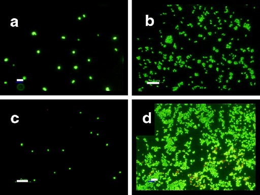 I batteri mangiano davvero la plastica