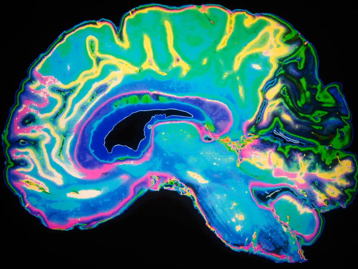 Perché le persone cieche mostrano attività nelle aree cerebrali di elaborazione visiva?