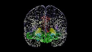 Gli scienziati hanno trovato un modo per misurare la depressione