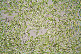 L’ alga che migliora la rigenerazione della pelle e la guarigione delle ferite
