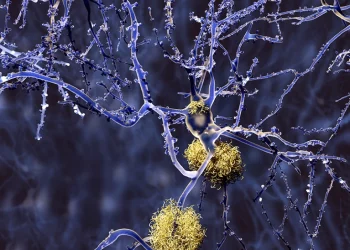 La FDA approva il farmaco per l'Alzheimer lecanemab