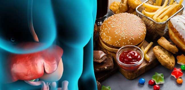 Il consumo di fast food correlato alle malattie del fegato