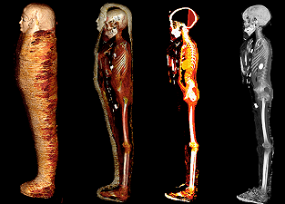 La mummia di golden boy: tutti i dettagli grazie alla TAC