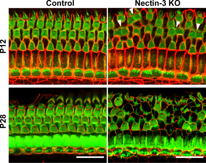 Le cellule a scacchiera che ci permettono di sentire