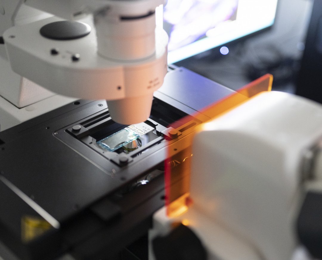 Invecchiamento cellulare: scoperta la causa