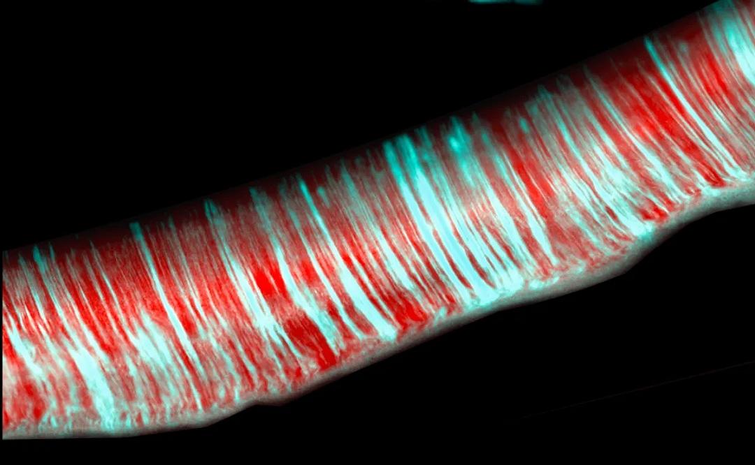 Escherichia coli: organismo con vita multicellulare segreta