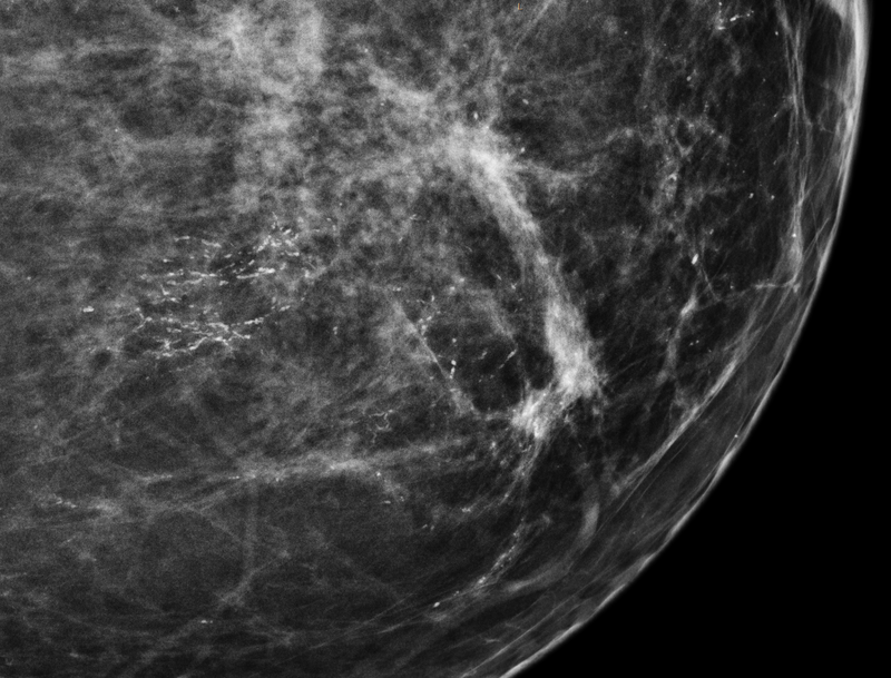 Le “impronte digitali” che informano sul cancro