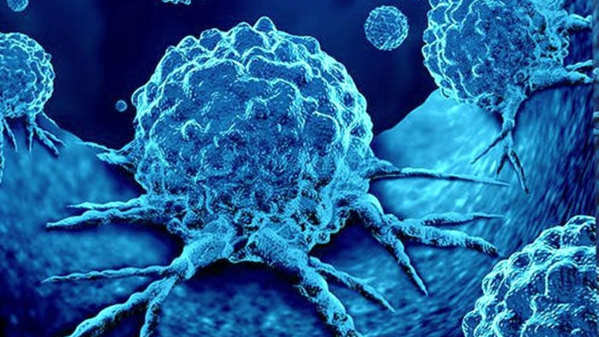 Tumori: le sfide dell’oncologia