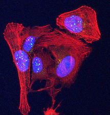I telomeri, questi sconosciuti, hanno un ruolo chiave nella genesi del cancro