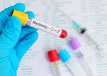 Virus di Marburg: cos'è e come colpisce l'uomo