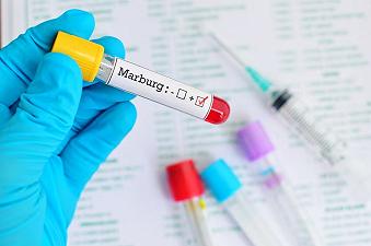 Virus di Marburg: cos’è e come colpisce l’uomo