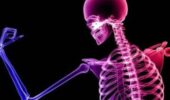 Bone health could be a risk factor for dementia