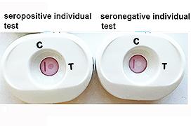 Il nuovo test “a dito” per una delle infezioni sessualmente trasmissibili più diffuse