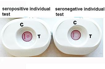 Il nuovo test “a dito” per una delle infezioni sessualmente trasmissibili più diffuse