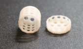 3D printed scaffold for breast reconstruction after mastectomy