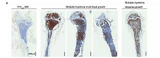 Gli scienziati creano avatar di topi per trattare il mieloma multiplo