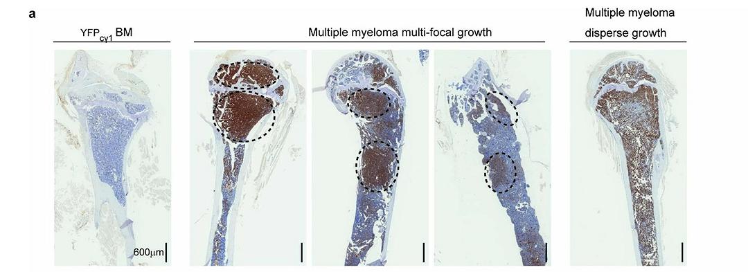 Gli scienziati creano avatar di topi per trattare il mieloma multiplo