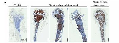 Gli scienziati creano avatar di topi per trattare il mieloma multiplo