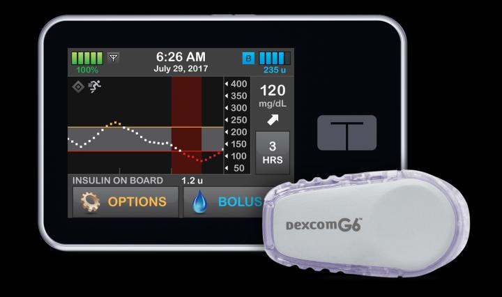 Diabete: i pancreas artificiali per bambini e adulti