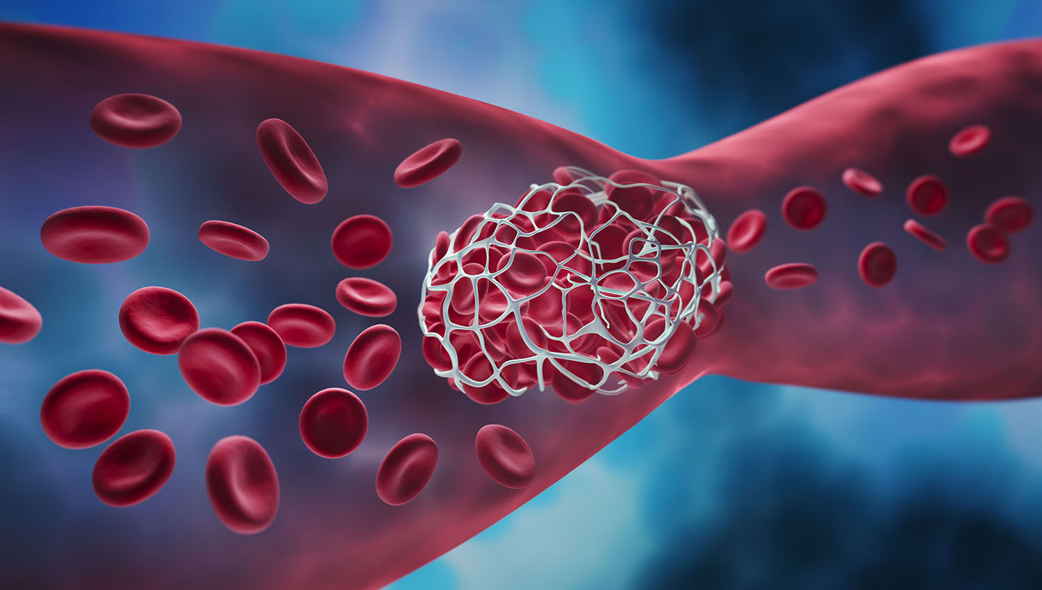 Anticoagulanti: le ricette al centro del report AIFA