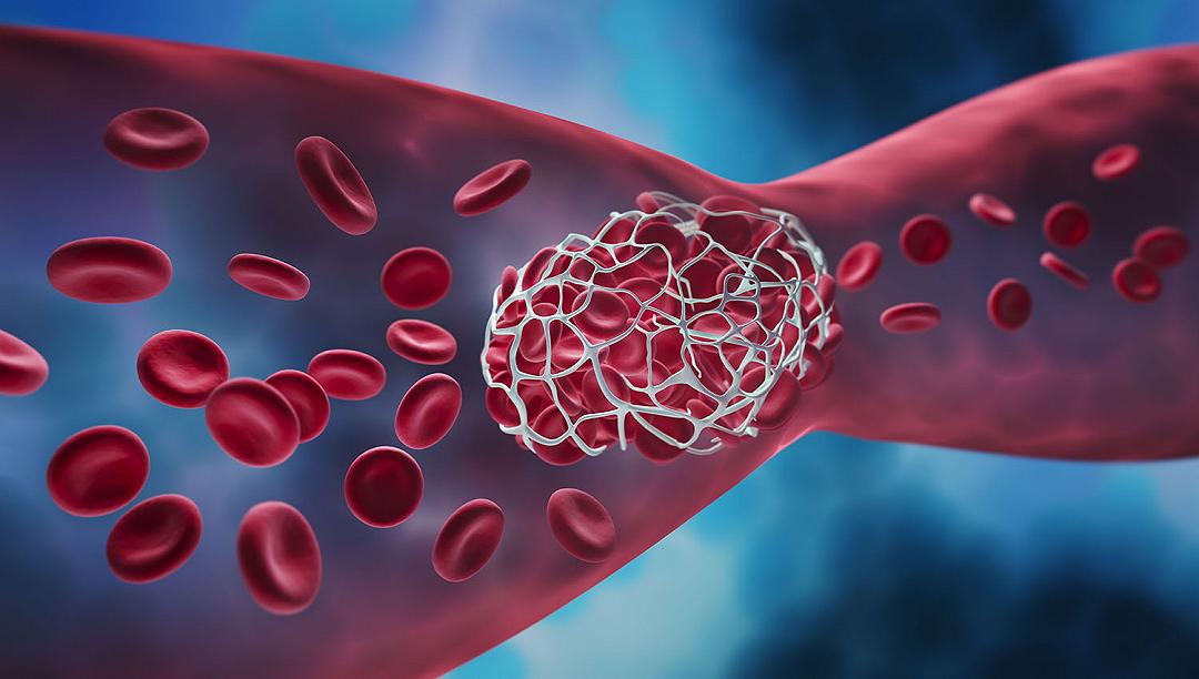 Anticoagulanti: le ricette al centro del report AIFA