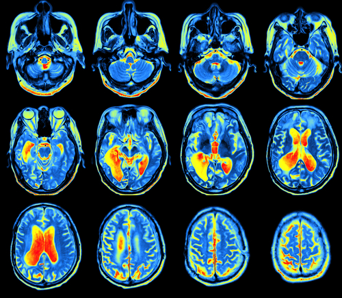 Questo è il tuo cervello nella vita di tutti i giorni