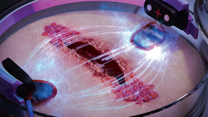 Come l’elettricità può guarire le ferite tre volte più velocemente