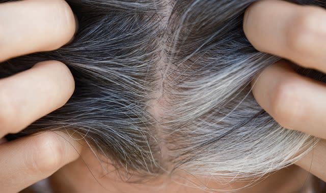 Capelli grigi: uno studio ne associa l’insorgenza alle cellule staminali che si “bloccano”