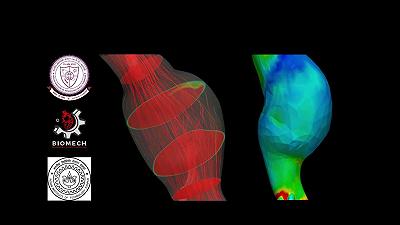 Individuare, prevedere e prevenire le rotture dell’aorta