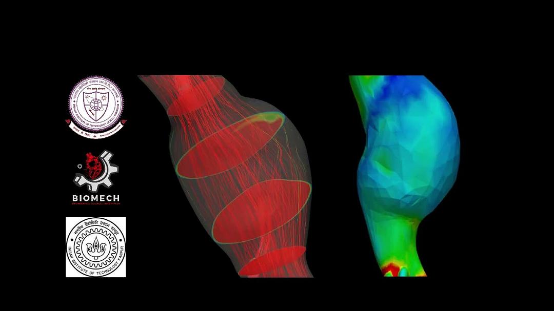 Individuare, prevedere e prevenire le rotture dell’aorta