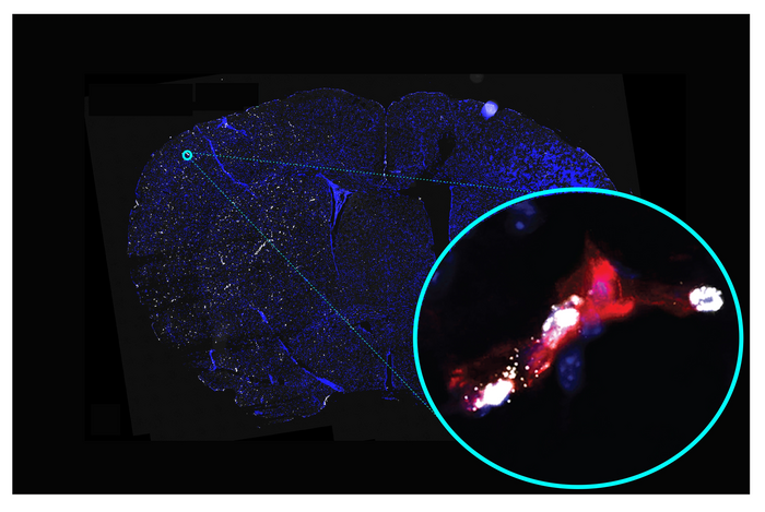 lo studio dei vasi sanguigni cerebrali e i nuovi farmaci per il trattamento dell’ictus