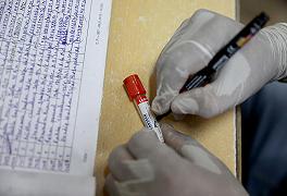 Malaria: approvato il primo vaccino per i bambini