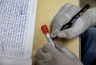 Malaria: approvato il primo vaccino per i bambini