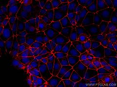 Occludina: la proteina umana che aiuta il coronavirus ad infettare le cellule