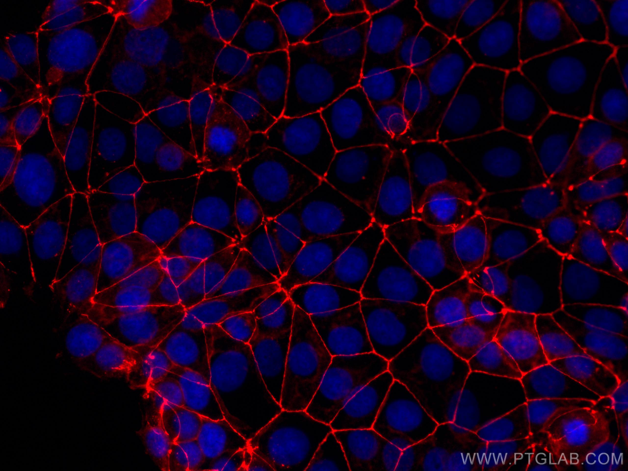 Occludina: la proteina umana che aiuta il coronavirus ad infettare le cellule