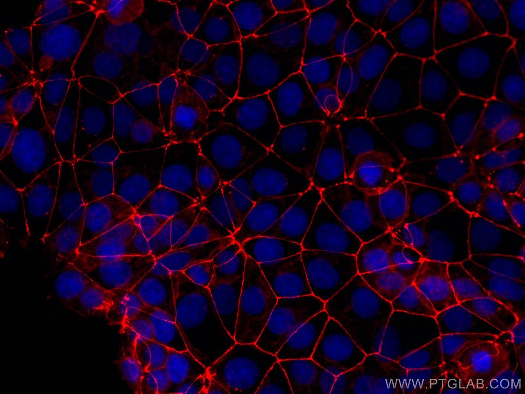 Occludina: la proteina umana che aiuta il coronavirus ad infettare le cellule