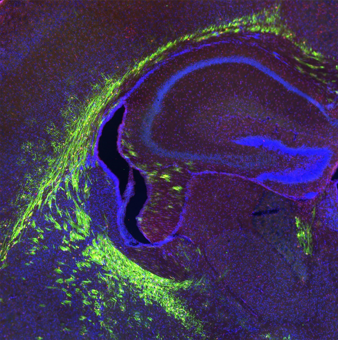 La proteina che salva il cervello: Mfsd2a, la portatrice di grassi omega3