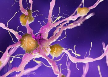 Alzheimer: nuova speranza grazie all'anticorpo monoclonale donanemab