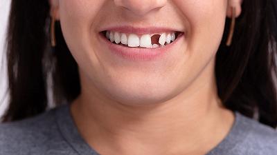 Un nuovo farmaco fa ricrescere i denti persi?