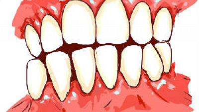 Il farmaco per la ricrescita dei denti è in fase di sperimentazione clinica