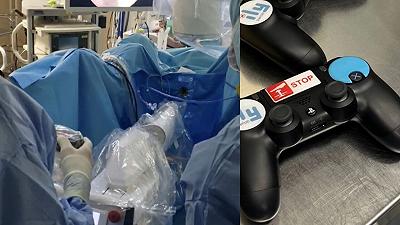 Chirurgia endoscopica avanzata: robot ILY con PlayStation utilizzato per curare i calcoli renali