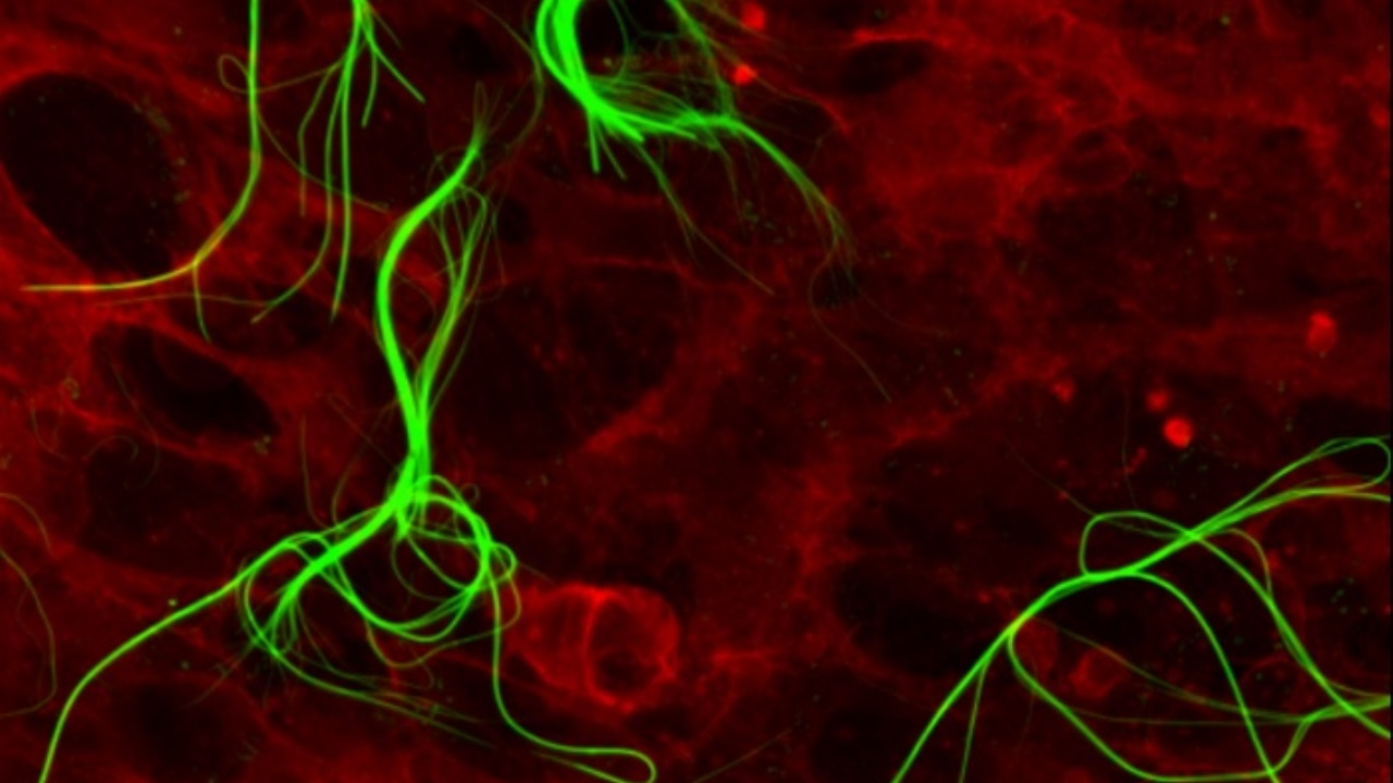 Molecole sintetiche: si auto-assemblano nelle cellule umane