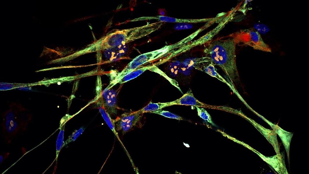 Un tempo cellule tumorali di rabdomiosarcoma, ora muscolo