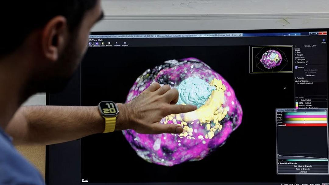 Scienziati israeliani creano un modello di embrione umano senza ovuli né spermatozoi