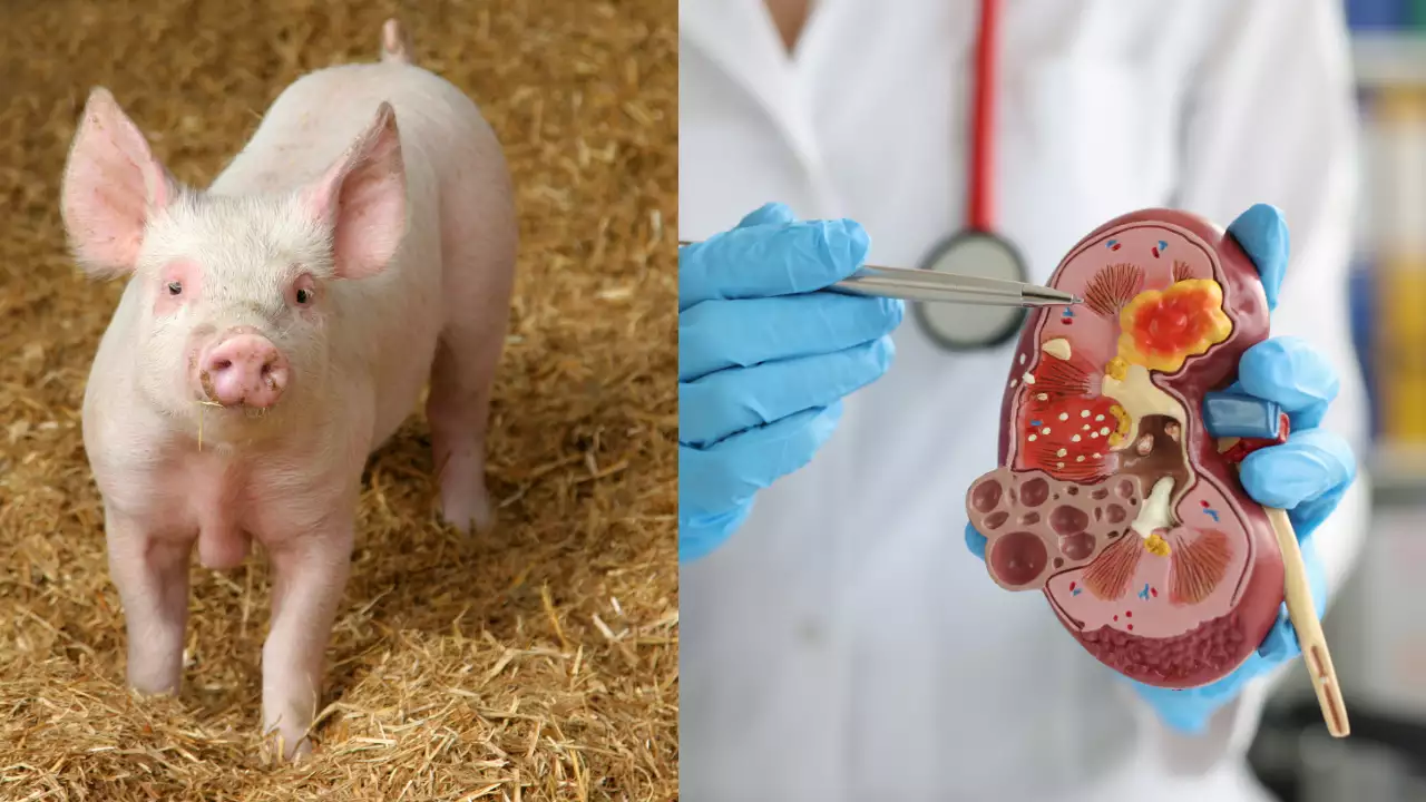 Organi umani coltivati in altri animali: la nuova alternativa contro la carenza di organi
