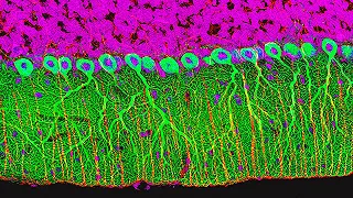 Il nuovo atlante completo del cervello umano: la prima mappa completa frutto di un nuovo studio