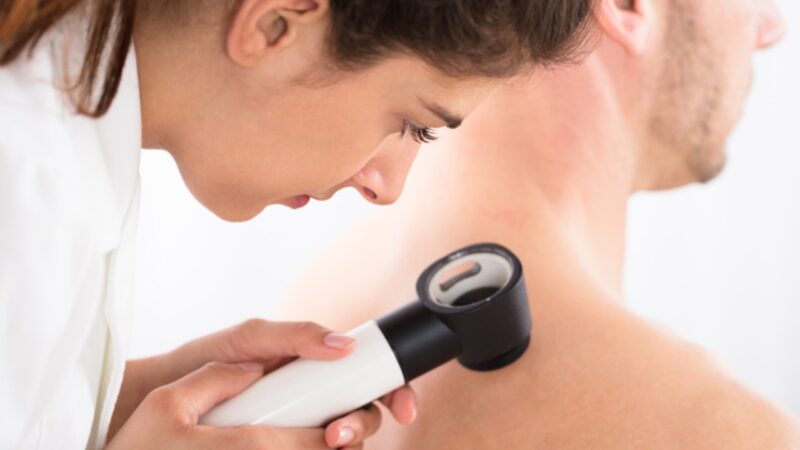 Melanoma: immunoterapia combinata con le molecole ipilimumab e nivolumab aumenta sopravvivenza