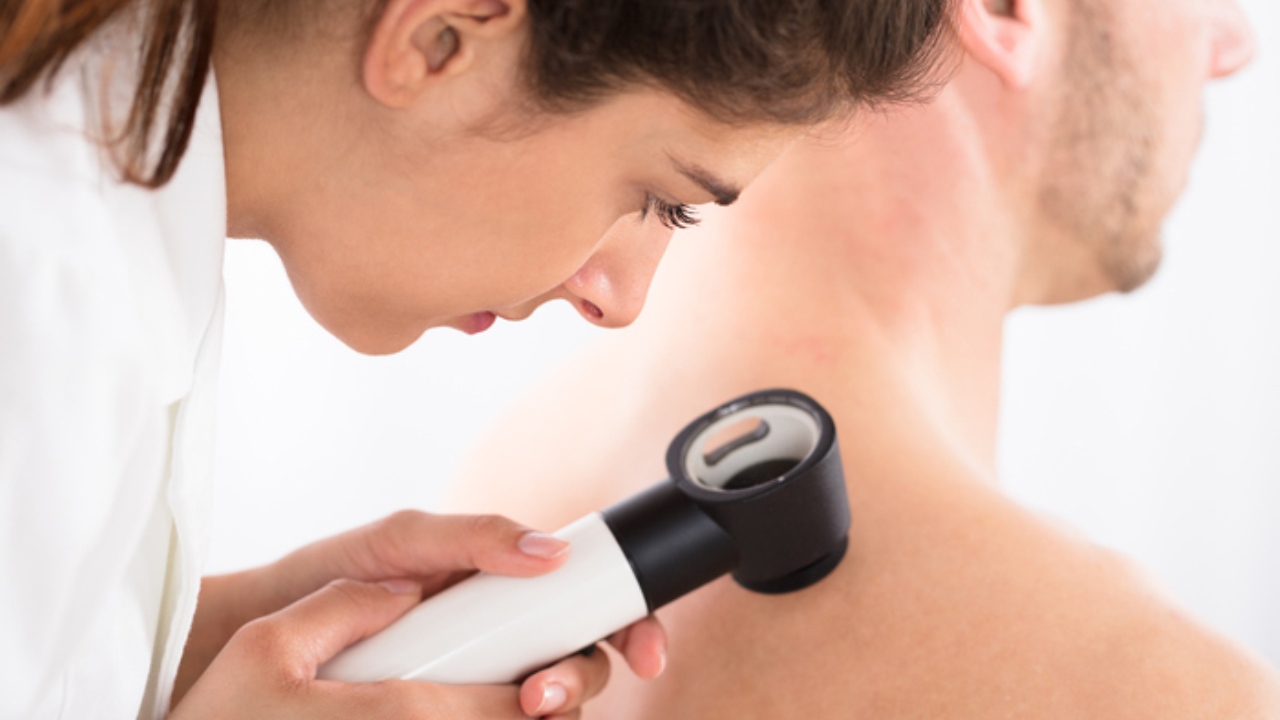 Melanoma: immunoterapia combinata con le molecole ipilimumab e nivolumab aumenta sopravvivenza