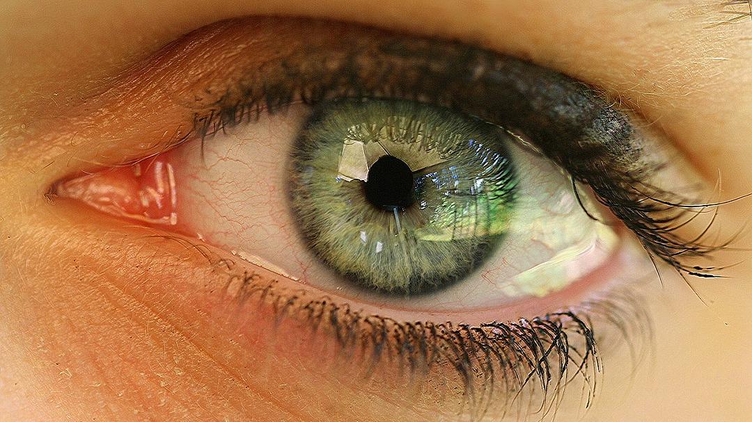 Pupillometria automatizzata: un nuovo strumento per la prognosi delle lesioni cerebrali acute
