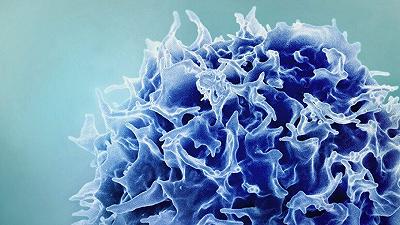 Tumori: arriva terapia genica innovativa per sconfiggere le metastasi al fegato
